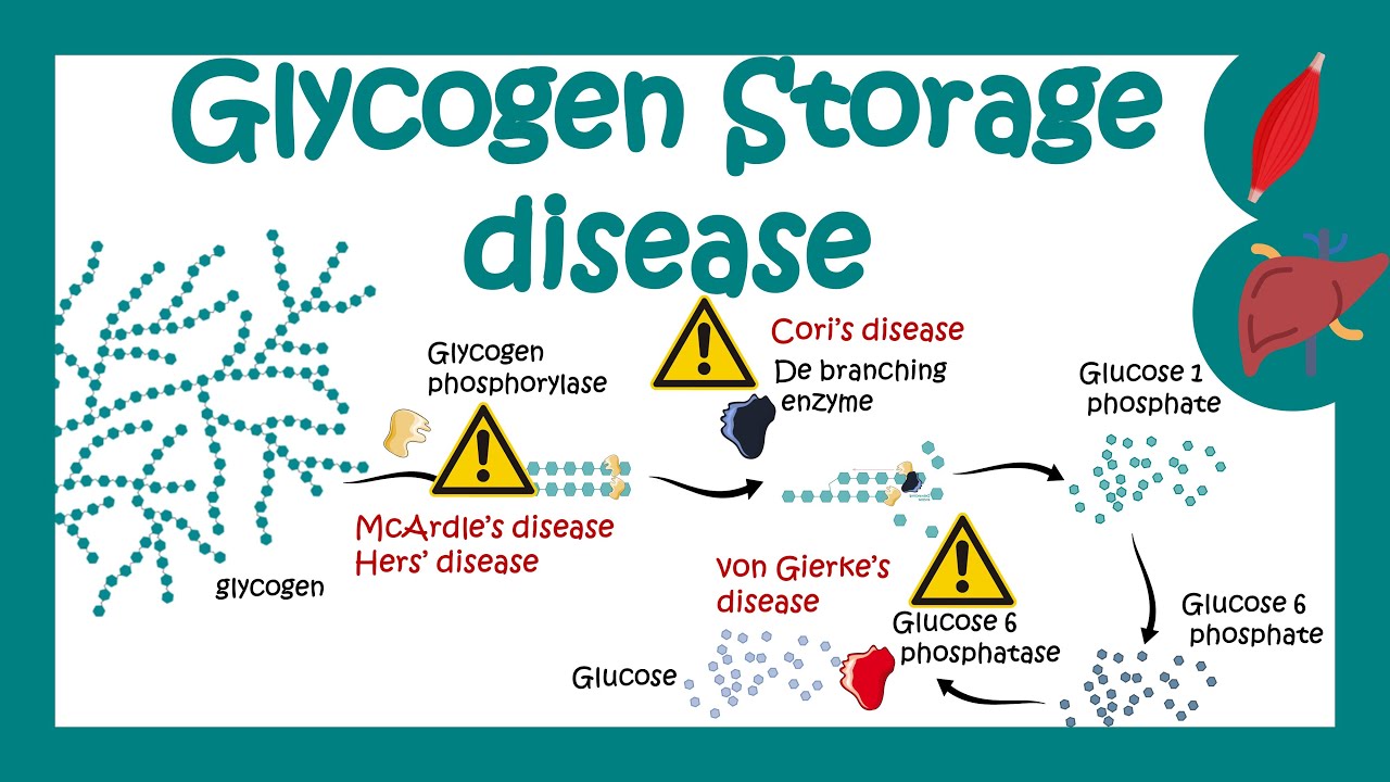 Research on glycogen storage disease